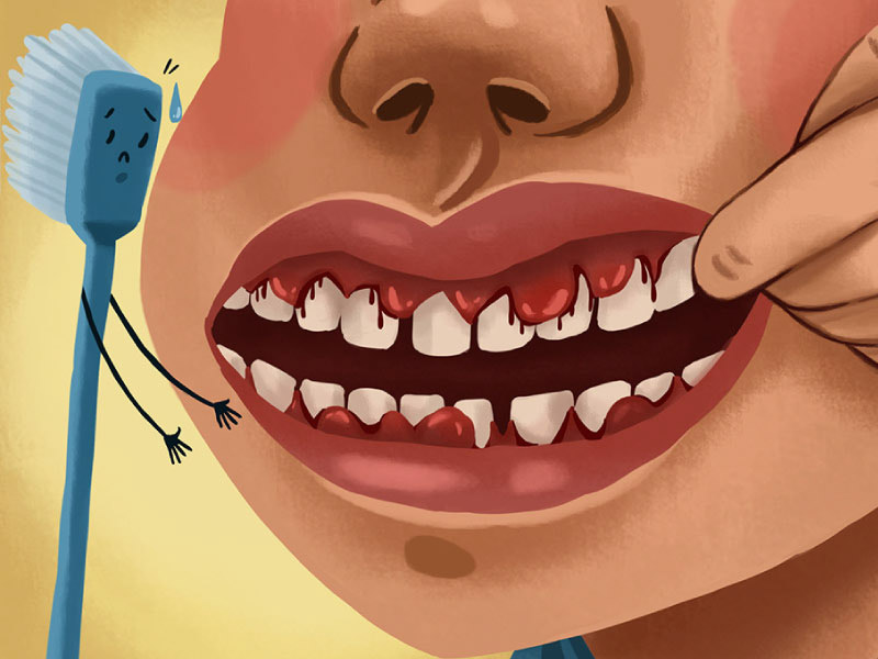 Cartoon picture of a mouth with bleeding gums next to a toothbrush with a sad face.