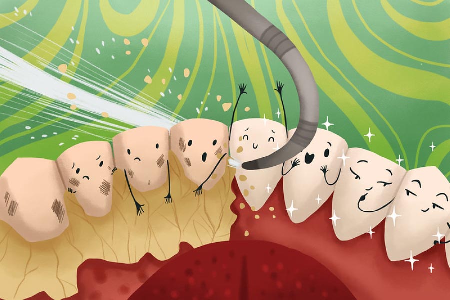 Cartoon of happy teeth getting a professional dental cleaning.