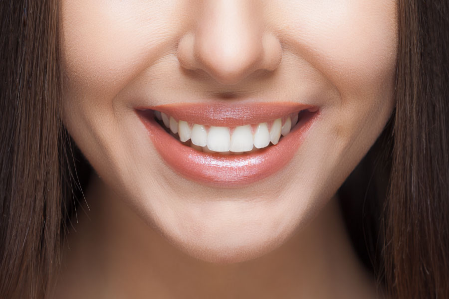 Lower half of a woman's face showing a smile with beautiful, white teeth.