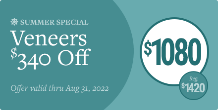 Summer Special: $1080 Veneers. Save $340.